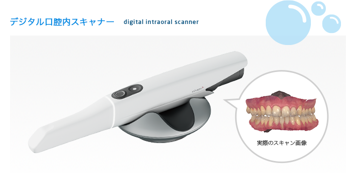 デジタル口腔内スキャナー